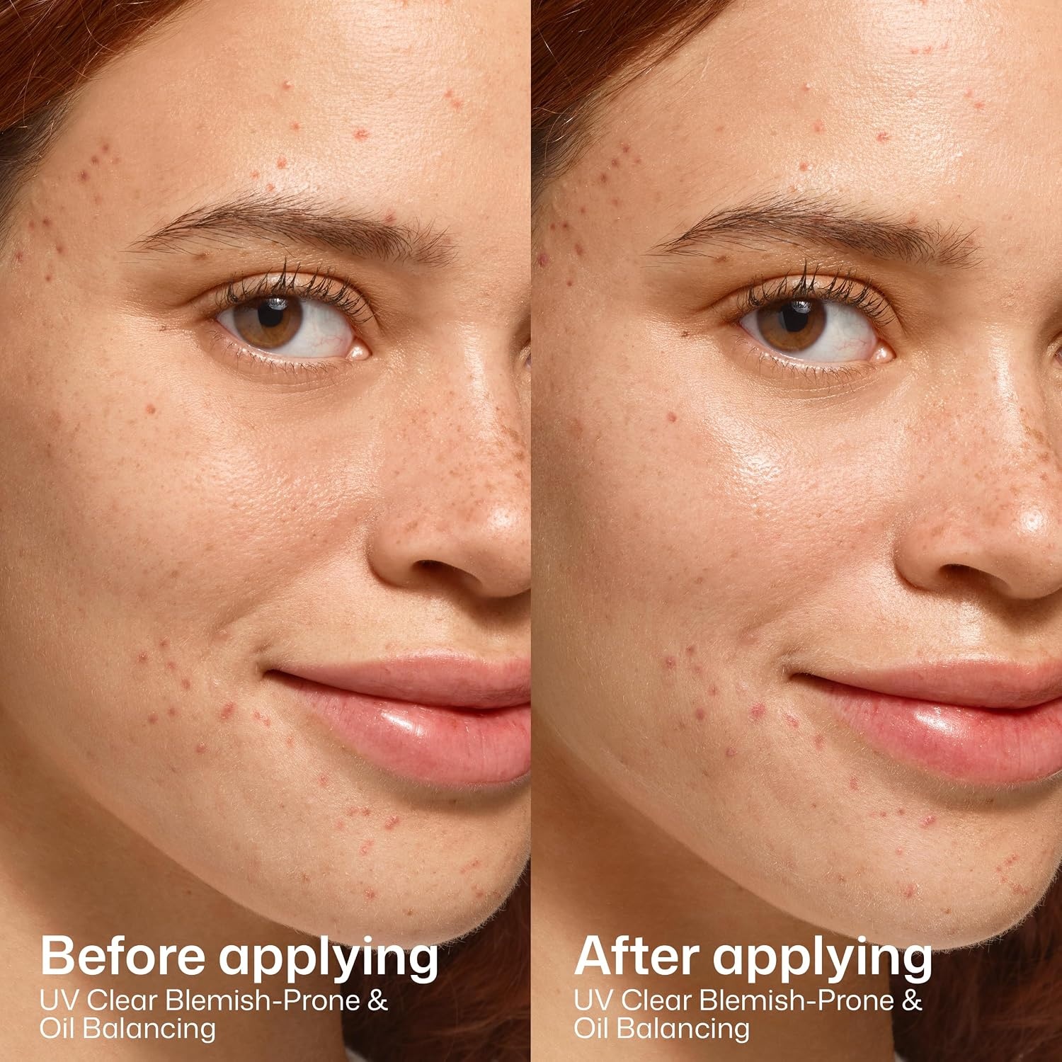 image:imageEltaMD UV Clear Face Sunscreen with Zinc Oxide OilFree SPF 46 and SPF 50 Calms and Protects AcneProne Skin and Rosacea No White Cast Dermatologist Recommended Available in Three Tints and Sizes01 New Blemish Prone 17 oz