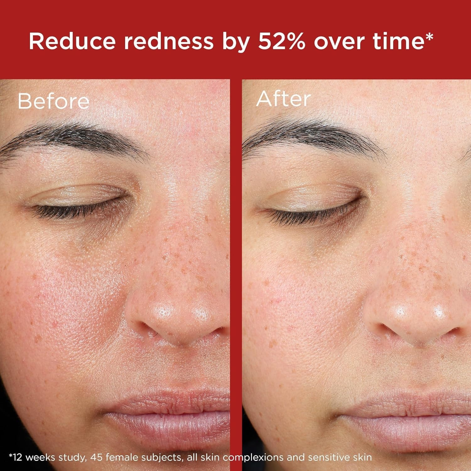 image:imageEltaMD UV Skin Recovery 100 Mineral Face Sunscreen SPF 50  Red Color Correcting Safe For Rosacea and PostProcedure Skin No White Cast Zinc Oxide Dermatologist RecommendedGreen Tinted Pack of 2