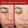 EltaMD UV Skin Recovery 100% Mineral Face Sunscreen, SPF 50 | Red Color Correcting, Safe For Rosacea and Post-Procedure Skin, No White Cast, Zinc Oxide, Dermatologist Recommended(Green Tinted (Pack of 2))