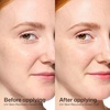EltaMD UV Skin Recovery 100% Mineral Face Sunscreen, SPF 50 | Red Color Correcting, Safe For Rosacea and Post-Procedure Skin, No White Cast, Zinc Oxide, Dermatologist Recommended(Green Tinted (1.7 oz))