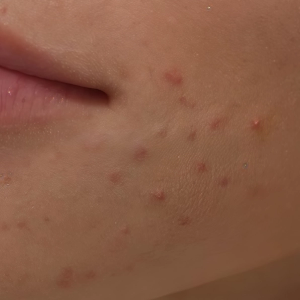 Sensitive Skin Sunscreen and Anti Aging Support