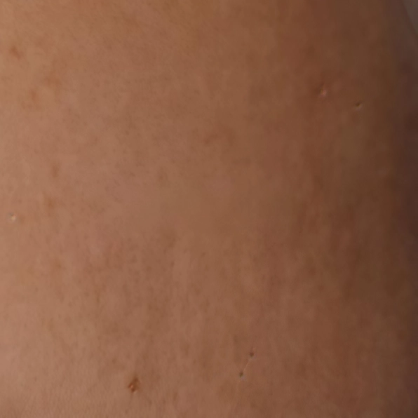 Sensitive Skin Sunscreen and Anti Aging Support